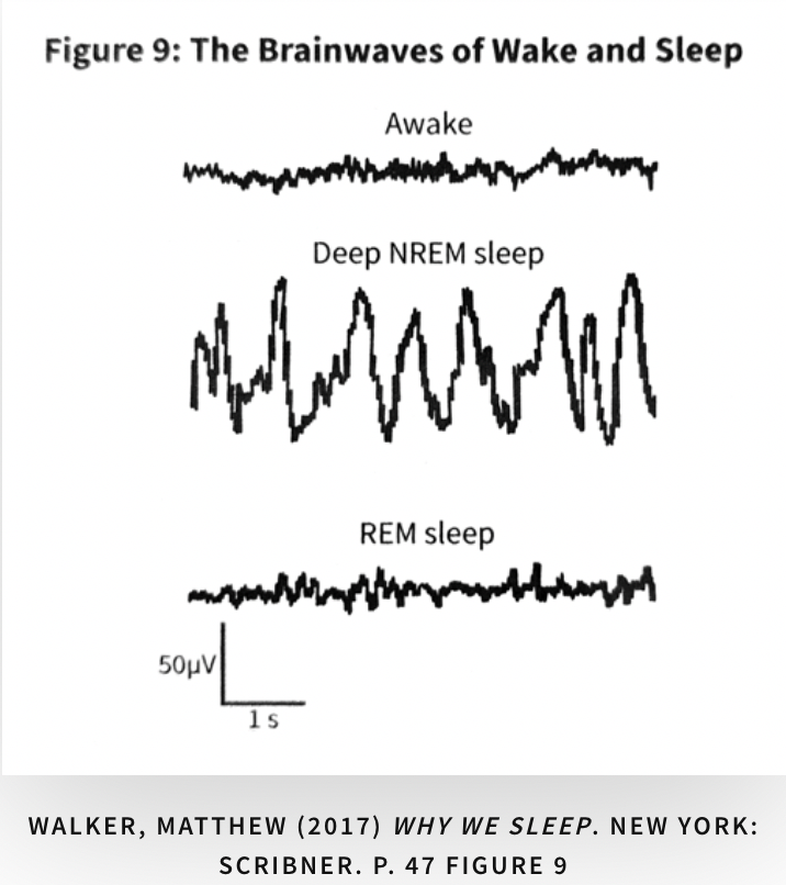 Стадии non Rem сна. Rem фаза сна. Non Rem фазы сна что это. Мозговые волны бодрствования и сна.