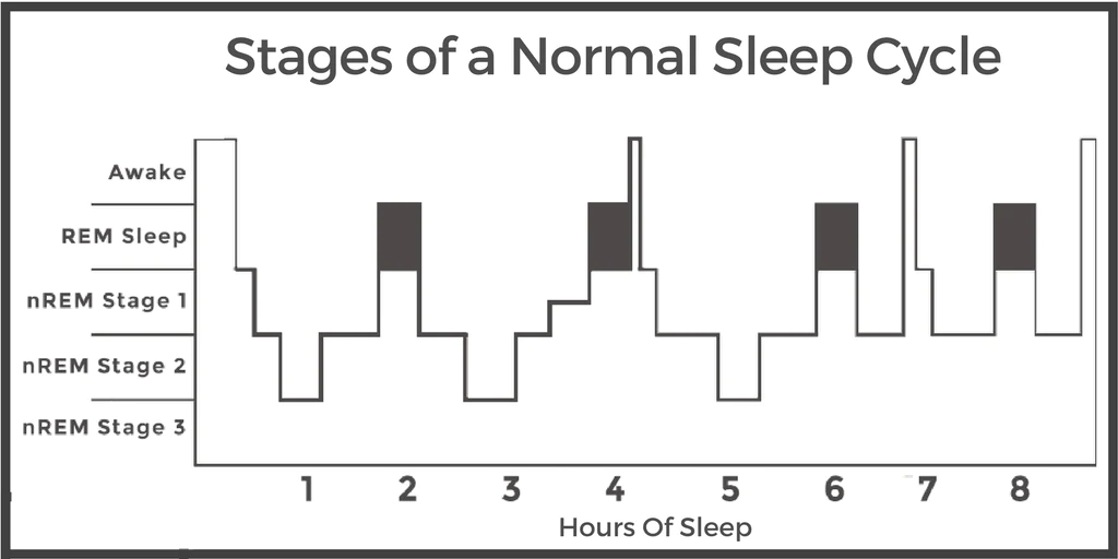 sleep stages hypnogram