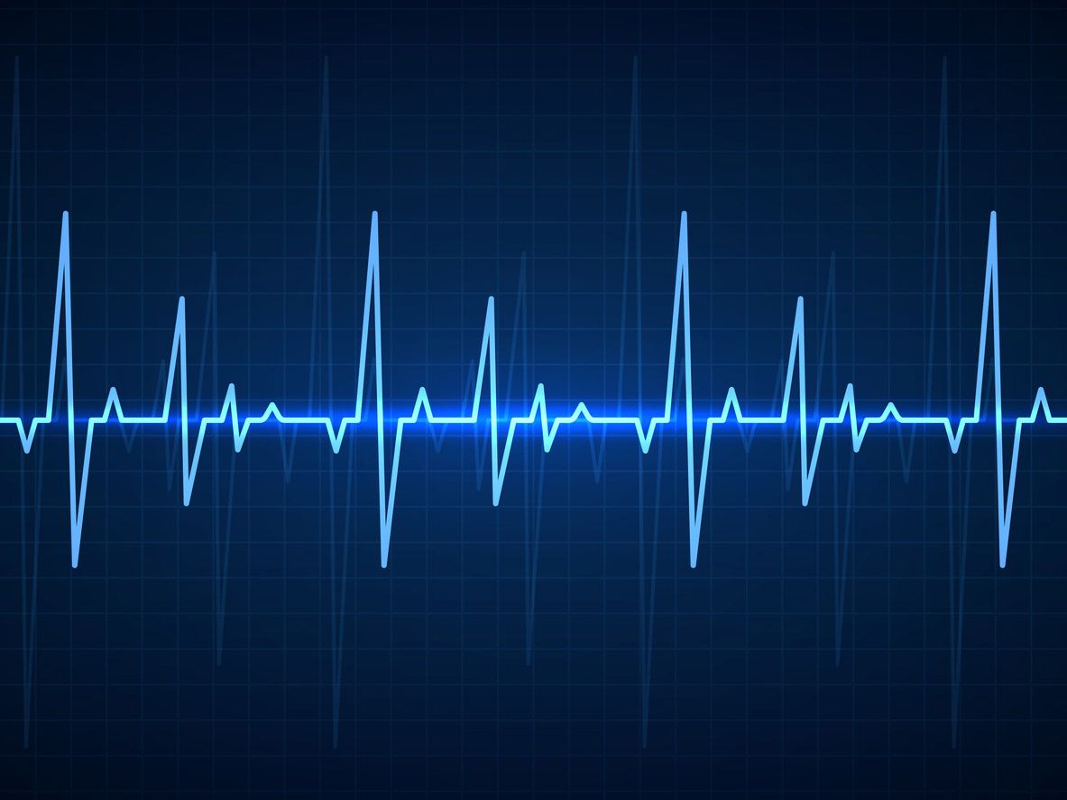 Heart Rate Variability (HRV): what it is, and why it matters to your health and your sleep
